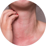 Irritation/Skin Allergy Image